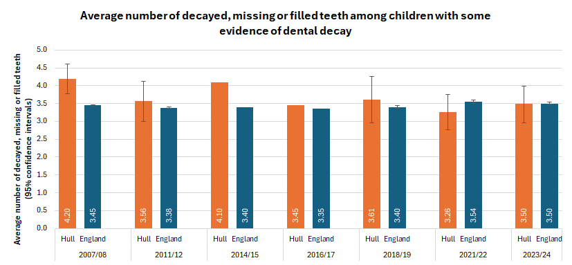 Average number of decay teeth, missing teeth (extracted due to dental decay) and filled teeth among the subset of five year olds taking part in the national five year old dental survey who showed some evidence of dental decay, trends over time, Hull compared to England