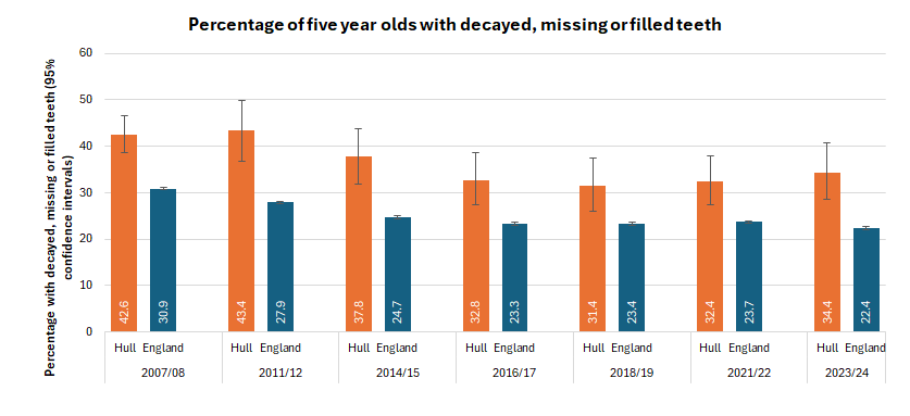 Percentage of children with one or more decayed teeth, missing teeth (extracted due to dental decay) and filled teeth among all five year olds taking part in the national five year old dental survey, trends over time, Hull compared to England